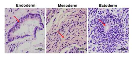 in-vivo상에서 유도 만능 줄기세포의 teratoma 형성을 통해 삼배엽 분화능 확인.