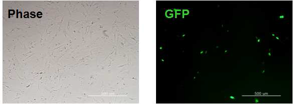 non-viral system 도입을 위한 플라스미드 클로닝과 GFP 발현 확인.