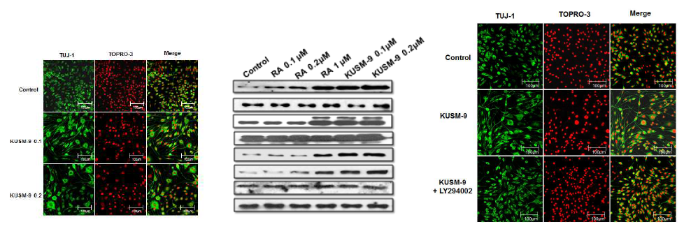 KUSM-9에 의한 신경아세포종의 신경분화 촉진 및 연관 신호전달체계 확인