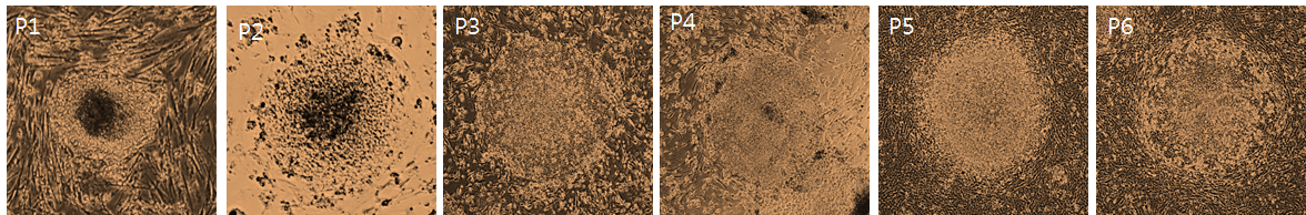 선별된 유도만능 줄기세포의 각 passage 에서의 대표적인 이미지 사진.