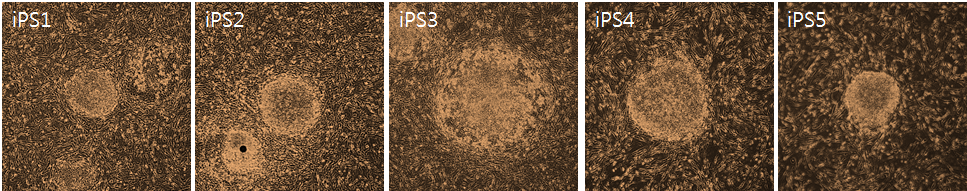 배아줄기세포의 특성을 지니는 세포주를 확립. 레트로바이러스를 이용하여 역분화 인자와 화학물질을 처리하여 만든 유도만능 줄기세포 주.