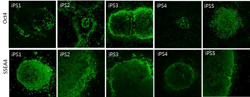 배아줄기세포 마크 Oct4와 SSEA4의 면역 형광 염색법을 이용한 confocal 현미경 사진 (200배 배율)