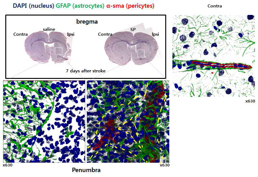 Stroke 유발 7일 후 ipsilateral penumbra에서 pericytes 는 􌩀-SMA으로, astrocytes는 GFAP의 면역형광염색으로 관찰하 여 SP 투여군에서 pericyte의 침투 및 증식 및 BBB구성에 필수 적인 astrocytes의 침투 및 증식을 확인함.