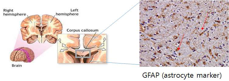 stroke 유발 2 일 후에 체외 배양된 MSC/EPC의 단독 및 SP와의 공동 이식을 contralateral corpus callusom에 sterotactic injection (B0.0, L2.0, D3.0)으로 수행하였으며, corpus callosum (GFAP+ astrocyte enriched area)을 통한 세포 의 이동과 infarcted penumbra와 core로의 homing을 위해 PKH-labeled MSC/EPC를 28일 후까지 추적함.