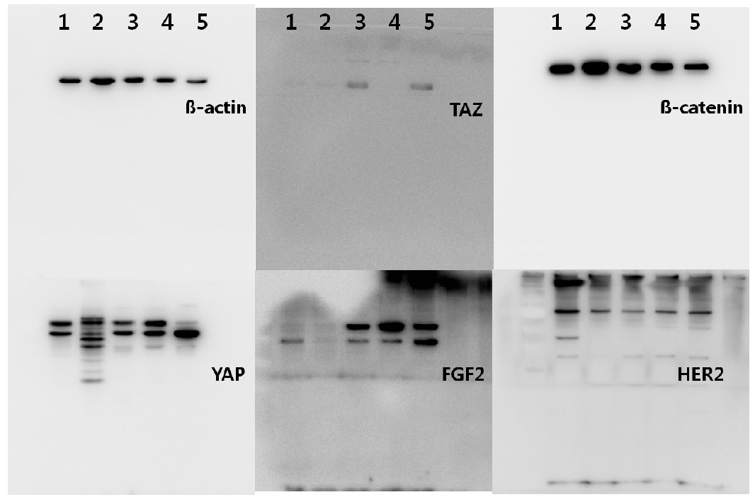 실제 위암 세포주를 사용한 웨스턴블랏(western blot) cell line 1, MKN-28; 2, MKN-45; 3, SNU-484; 4, SNU-638; 5, YCC-9