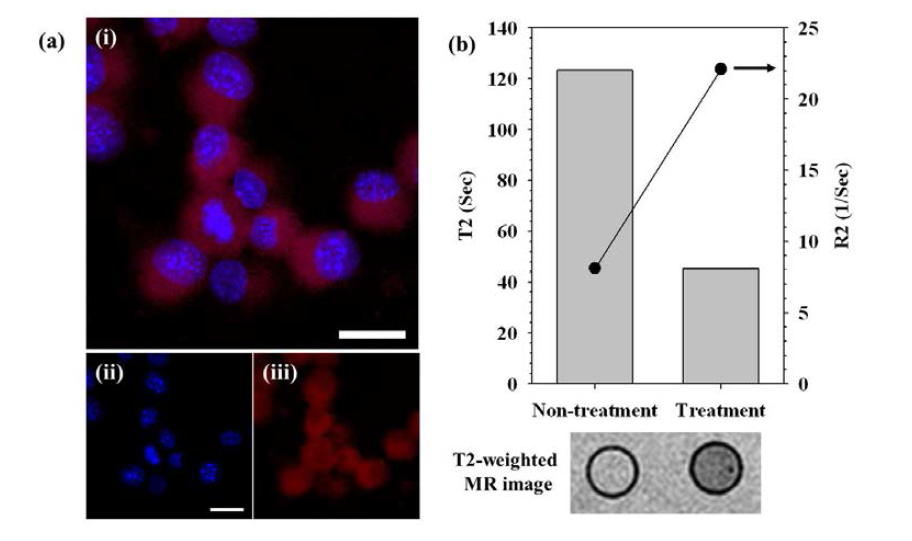 암 세포내 전달된 복합체의 현미경 영상 및 자기공명 영상/ 그래프