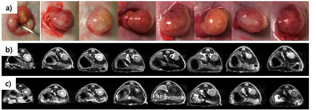 위암 세포주 주입(a) 후, 8일(b)과 15일(c) 경과 MRI 사진