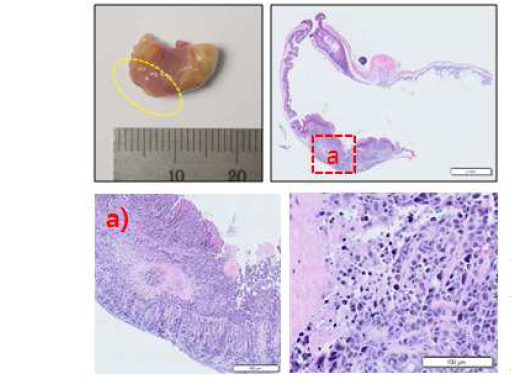 위암 이종동 소모델에서 적출한 위암조직의 H&E staining 사진