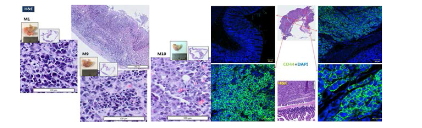 BALB/c nude mouse model(M1, M9, M10)에서 적출한 tumor 조직 slide의 H&E Staining (좌) Immunohistochemistry(우) 결과