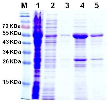 정제된 Full TAZ의 SDS-PAGE 분석 결과 M, 단백질 Size maker; 1, 과 발현시킨 대장균 현탁액; 2~3, Resin 결합하지 못한 현탁액; 4~5, 100 mM 이미다졸 (imidazole)용액을 사용하여 레진에서 분리한 Full TAZ