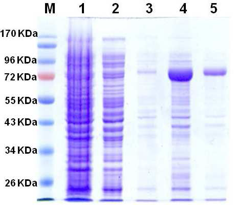 정제된Δ138 β-catenin의 SDS-PAGE 분석 결과 M, 단백질 Size maker; 1, 과 발현시킨 대장균 현탁액; 2~3, Resin 결합하지 못한 현탁액; 4~5, 100 mM 이미다졸 (imidazole)용액을 사용하여 레진에서 분리한 Δ 138 β-catenin