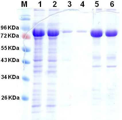 정제된 MBP-Δ143 Akt1 의 SDS-PAGE 분석 결과 M, 단백질 Size maker; 1, 과 발현시킨 대장균 현탁액; 2~4, Resin 결합하지 못한 현탁액; 5~6, 100 mM 이미다졸 (imidazole)용액을 사용하여 레진에서 분리한 MBP-Δ143 Akt1
