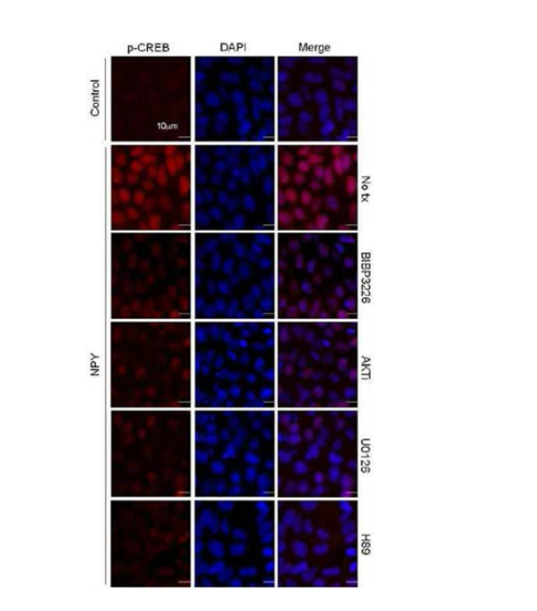 3 μM BIBP3226, 10 μM AKTi, 10μM U 0126 또는 10 μM H 89로 1시간 사전처리 유무에 따라 5분 동안 N PY로 처리한 인간 배아줄기세포의 면역조직화학 분석 결과