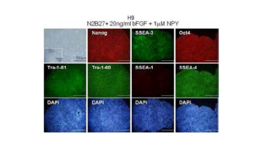 feeder-free, serum-free NPY-N2/ B27 배지에서의 hESC 유지배양