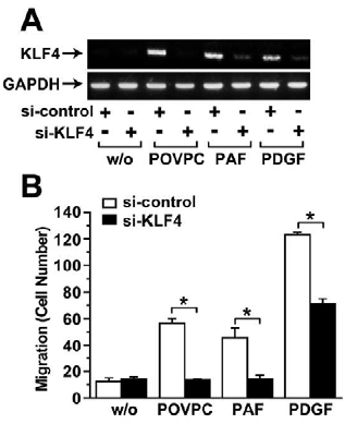POVPC, PAF에 의한 세포이동과정에 KLF4의 역할