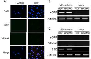 hVEcad-eGFP가 도입된 인간 표피아세포와 혈관평활근세포에서의 GFP, VEcad 발현