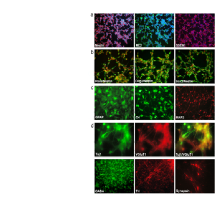 유도된 신경줄기세포 및 신경세포에서 발현하는 특이적 단백질을 Immunocytochemistry로 확인