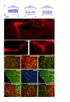 Photothrombotic Ischemia Model에서 유도된 신경줄기세포의 신경세포로의 분화 및 전기생리학적 작용 분석을 통하여 기능 확인