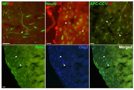 BrdU 와 CM-DiI label된 mMON 세포가 neurofilament, NeuN, APC-CC1, Olig2 marker와 double label된 것을 통해 공여세포가 neuron과 성숙 또는 미성숙 oligodenrocyte로 분화함을 확인함.