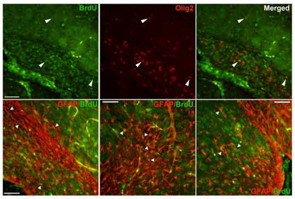 BrdU로 label된 mME3세포는 BrdU와 olig2, GFAP marker 각각과 double label된 것을 통해 미성숙 oligodendrocyte와 astrocyte로 분화함을 확인함.