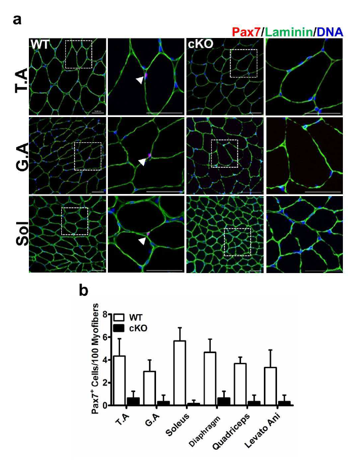 Mib1 결핍 마우스의 다양한 근육조직에서 근육 줄기세포의 수