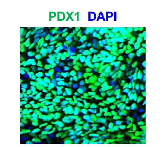 진정 내배엽 특이적 전사 인자인 PDX1의 단백질 수준 발현 확인 (scale bar : 10 um)