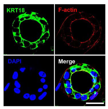 인간 배아 줄기세포 유래의 신장 전구세포에서 3차원 배양을 통한 관상피세포로 분화 유도시 면역형광염색 결과