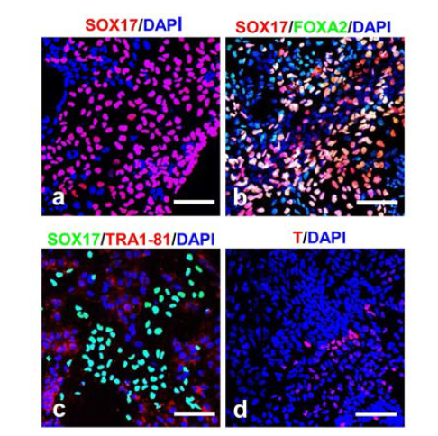 인간 역분화 줄기세포 유래의 내배엽 세포에서 내배엽 및 중/ 외배엽 특이 마커 발현에 대한 면역형광염색 결과