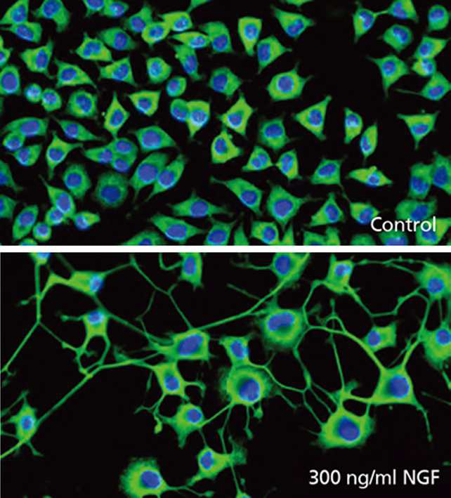 NGF처리 전후의 NS-1 세포