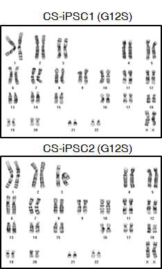 Costello 증후군 역분화줄기세포의 정상핵형 확인