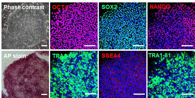 Costello 역분화줄기세포(CS-1)의 줄기세포 마커발현 확인