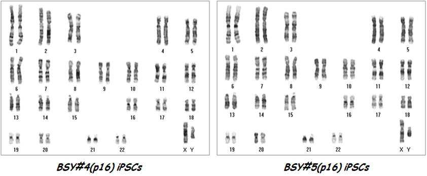 BSY 역분화 줄기세포주의 핵형 확인
