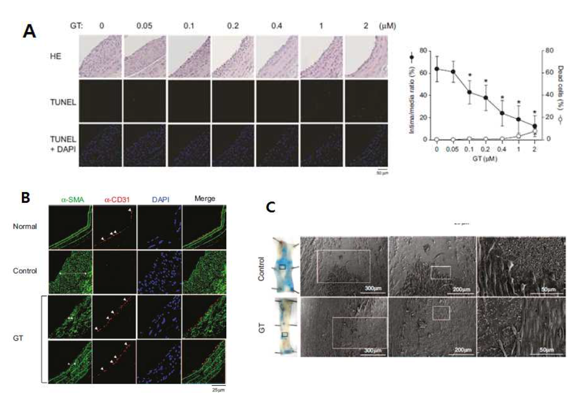 A. Prx 모방체 Gliotoxin의 농도에 따른 balloon injury 후 혈관 내막 두꺼워짐 감소 효과 관찰. B. 혈관내피세포 표면 마커 CD31 형광 염색을 통해 injury후 Gliotoxin 처리한 혈관의 내피세포 성장이 촉진되어 있음을 확인. C. 정상군과 gliotoxin 처리군의 Evans blue 염색 사진 및 SEM 이미지를 통해 펼쳐진 혈관의 Lumen 촬영 사진.
