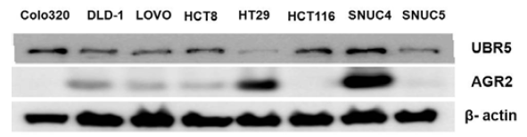 여러 가지 대장암 세포주에서의 암줄기세포 조절자인 AGR2 및 UBR5의 발현