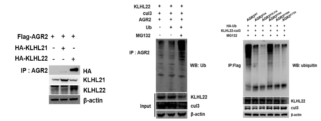 AGR2와 KLHL22의 결합 확인 및 KLHL22에 의한 AGR2의 유비퀴틴화 확인