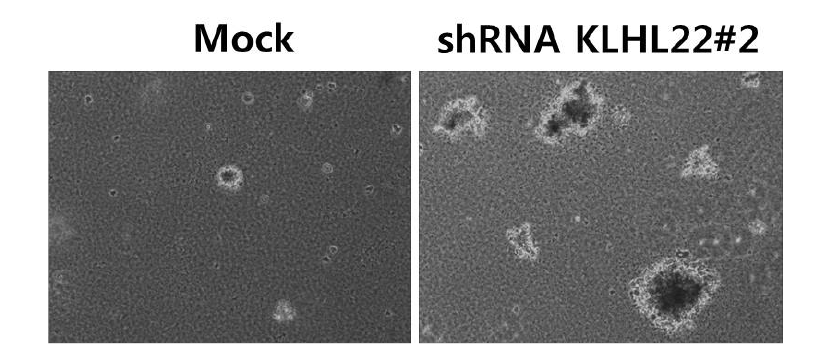 KLHL22 발현 조절에 의한 암줄기세포의 sphere 형성능 확인