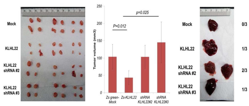 KLHL22 발현 조절에 의한 암 성장 및 전이 능력 확인