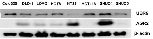 여러 가지 대장암 세포주에서의 암줄기세포 조절자인 AGR2 및 UBR5의 발현