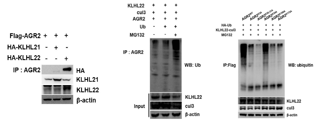 AGR2와 KLHL22의 결합 확인 및 KLHL22에 의한 AGR2의 유비퀴틴화 확인