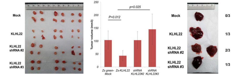 KLHL22 발현 조절에 의한 암 성장 및 전이 능력 확인