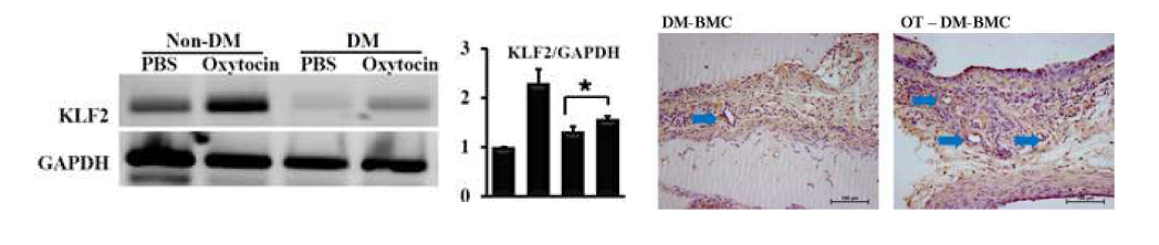 당뇨MSC에서 감소되어있던 혈관기능 인자인 KLF2가 oxytocin 처리로 회복되었고, 혈관신생 또한 향상되었음 (Matrigel assay).