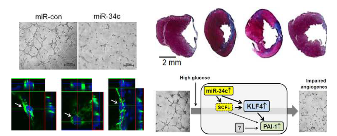 miR-34c는 MSC의 HG에 반응하여 유도되고, 이후 신호전달계를 통해 혈관생성 및 심근치료능을 저하시킴