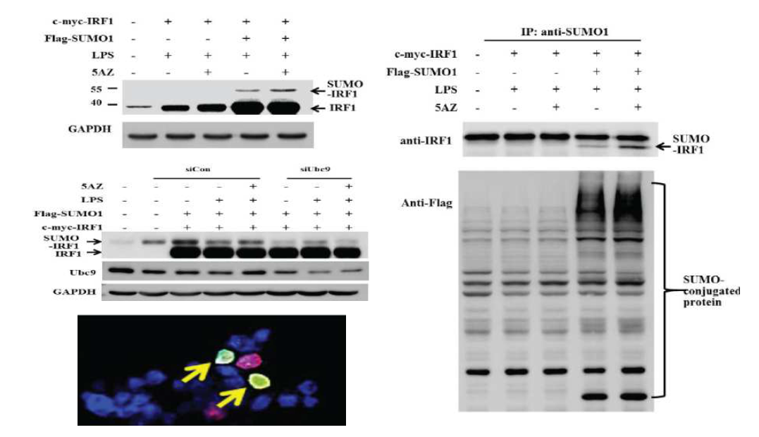 5AZ는 IRF1의 sumoylation을 유도하여 단백분해로부터 보호되고, 항염증표현형을 유도함.