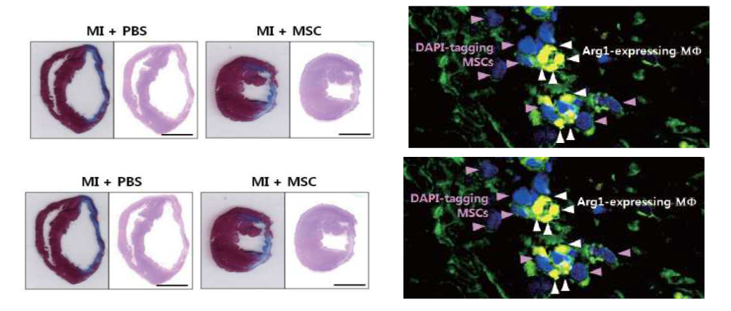 경색심근에 이식된 MSC의 주변 대식세포는 항염증성 M2 표현형을 보였음.