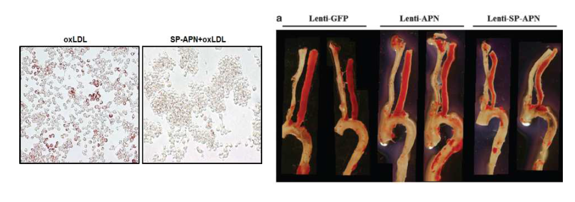 마우스 동맥경화모델에 대식세포-특이 adiponectin 유전자 적용하여 치료효과를 확인하였음.