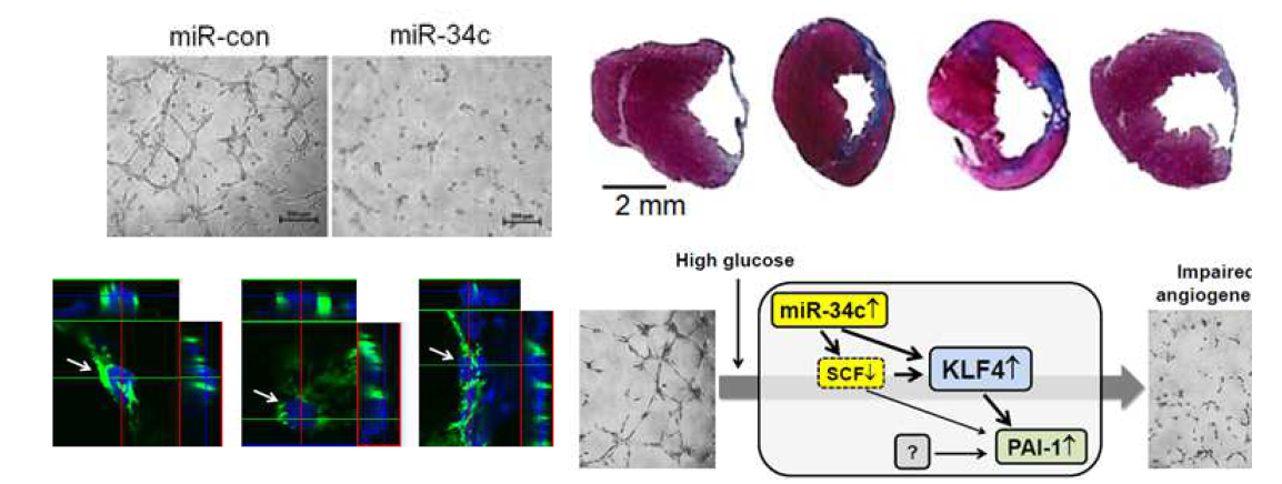 고농도 포도당 스트레스에 의한 MSC의 치료기능 소실 과정에 miR-34c가 개시인자로 작용함을 4세부 전남대와 1세부 서울대가 공동 수행하여 세포기능 및 치료효과 연구(4세부)와 miR 기전연구(1 세부)를 진행하였음.