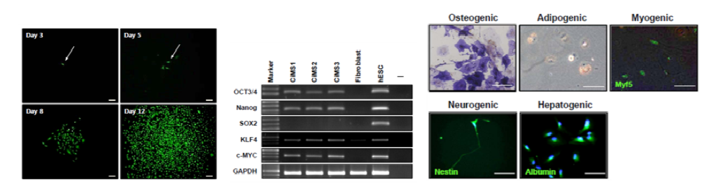 CiMS의 콜로니 형성 모습과 stemness 유전자의 발현 및 삼배엽으로의 분화