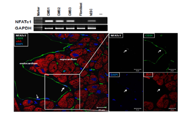 CiMS의 마커인 NFATc1의 발현과 심장에서의 CD31, NFATc1염색으로 심장내막에 존재하는 CiMS를 동정함