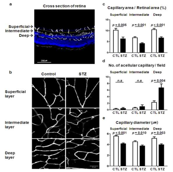 Streptozotocin (STZ) 유발 당뇨 쥐의 망막에서 혈관 변화를 관찰