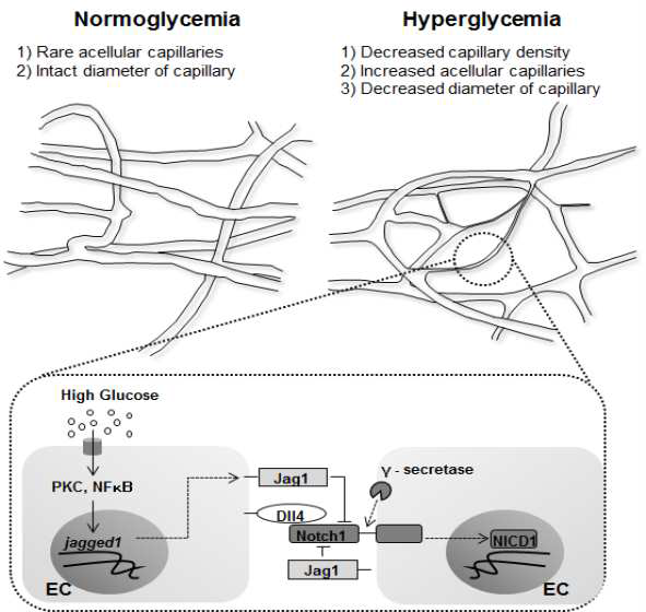 당뇨 혈관 니쉬에서 Notch 신호 전달 기전에 대한 모식도